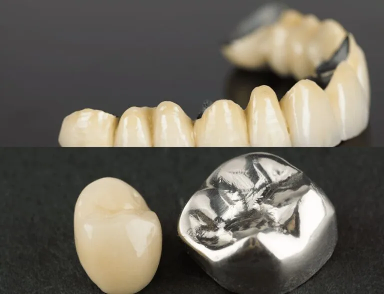 Smilebook dental crowns