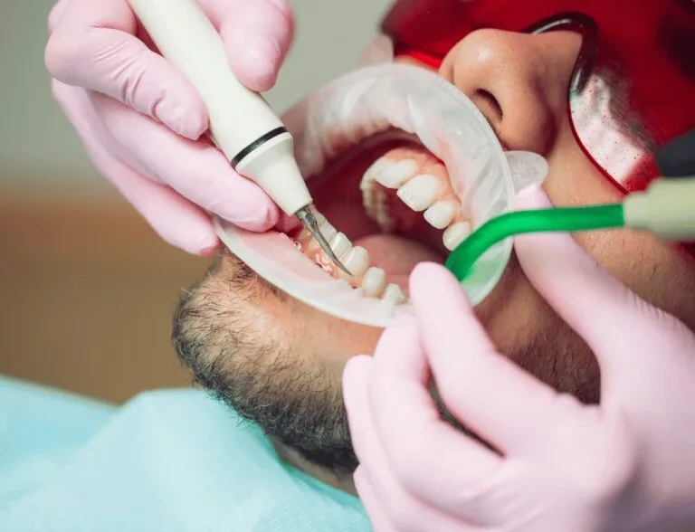 Root Canal Treatment cost in Hyderabad