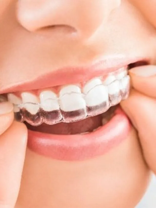 Best Dentist in Mallampet Hyderabad