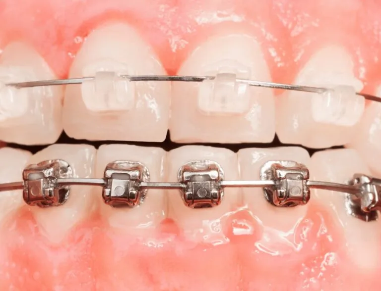 Smilebook dental 23