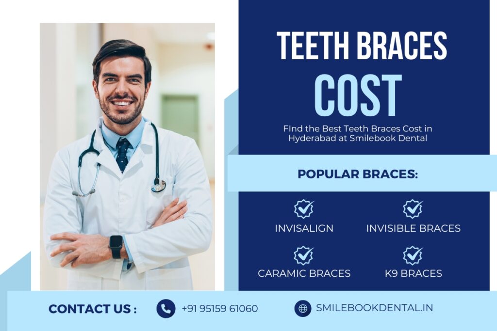 Teeth Braces Cost in Hyderabad Best Dentists Smilebook Dental