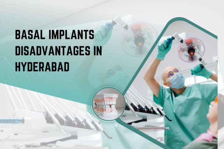 Basal Implants Disadvantages in Hyderabad