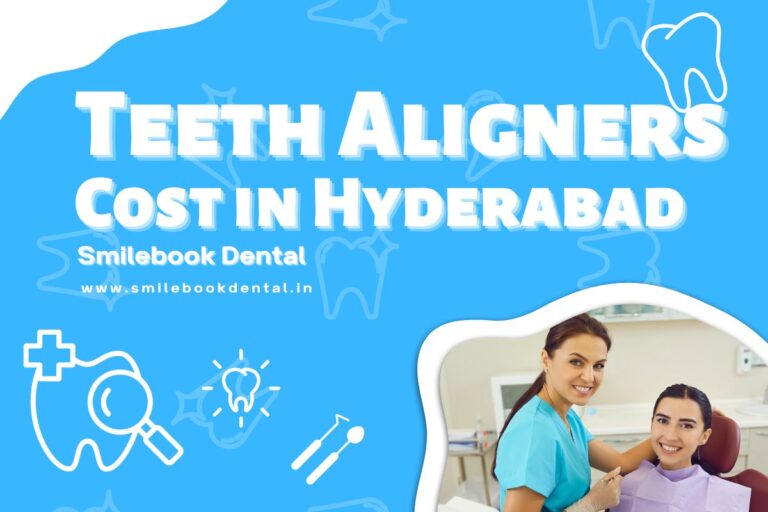 Teeth Aligners Cost in Hyderabad